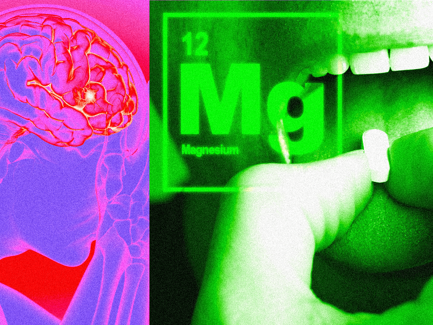 How Magnesium Can Help with Migraines, According to Experts